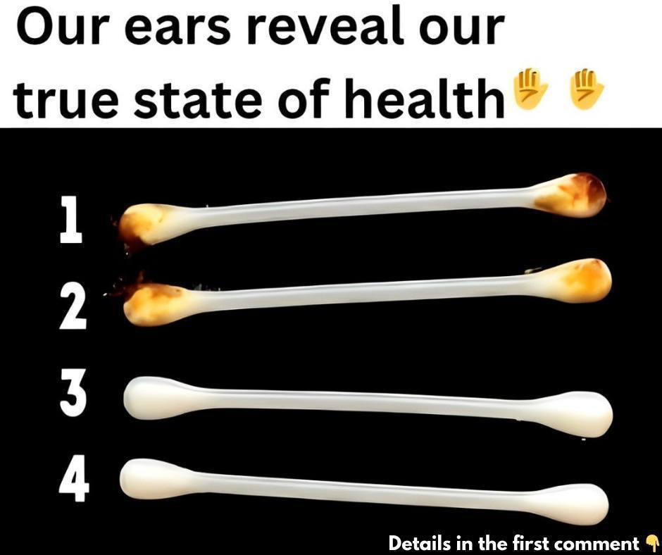 What Your Ears Reveal About Your Health: Hidden Signs Explained