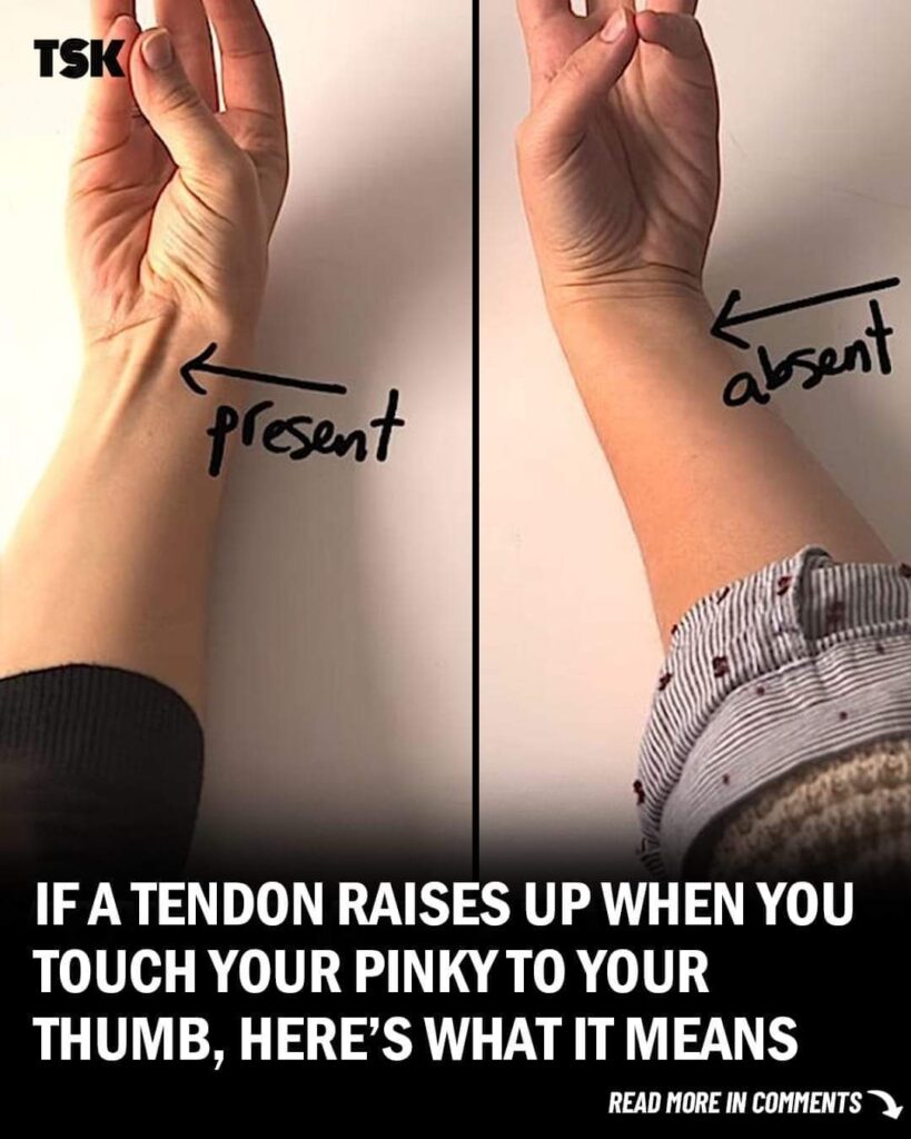 The Surprising Connection Between Your Tendon and Evolution