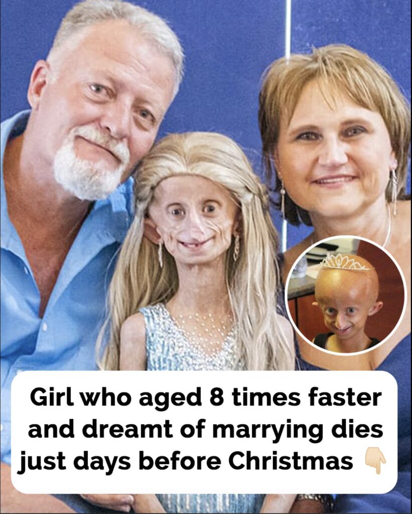 Teen who aged 8 times faster and dreamt of marrying passes away before Christmas: Her final message will make you cry 💔