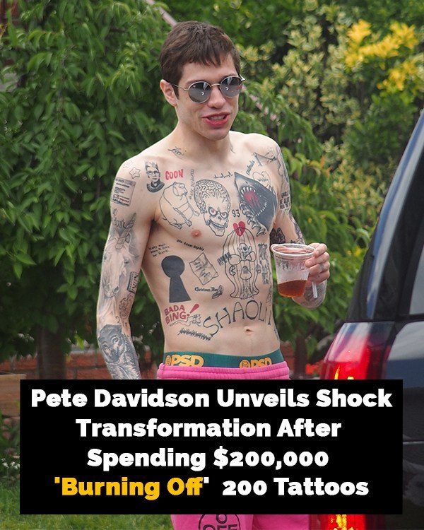 At 31, comedian Pete Davidson has revealed a shock transformation after “burning off” 200 tattoos covering his body 😳😳😳 Pics in comments 👇