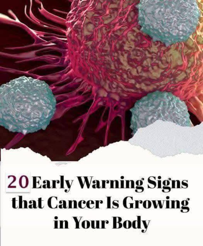 20 Early Signs Your Body is Fighting Cancer….😳😨 Read more below 👇 💬