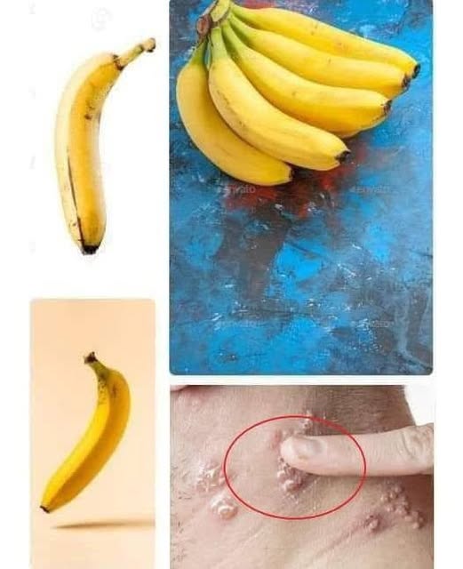 Did you know that it you eat BANANA EVERY DAY your body can… See more in first comment