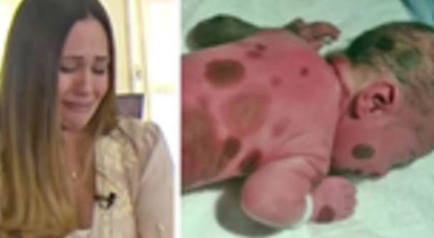 Baby is born with black spots , then mom learns the horrific truth… 😰 Full story below: