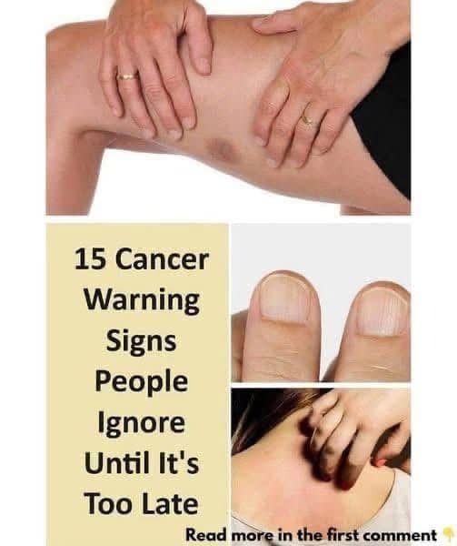 15 Cancer Warning Signs People!