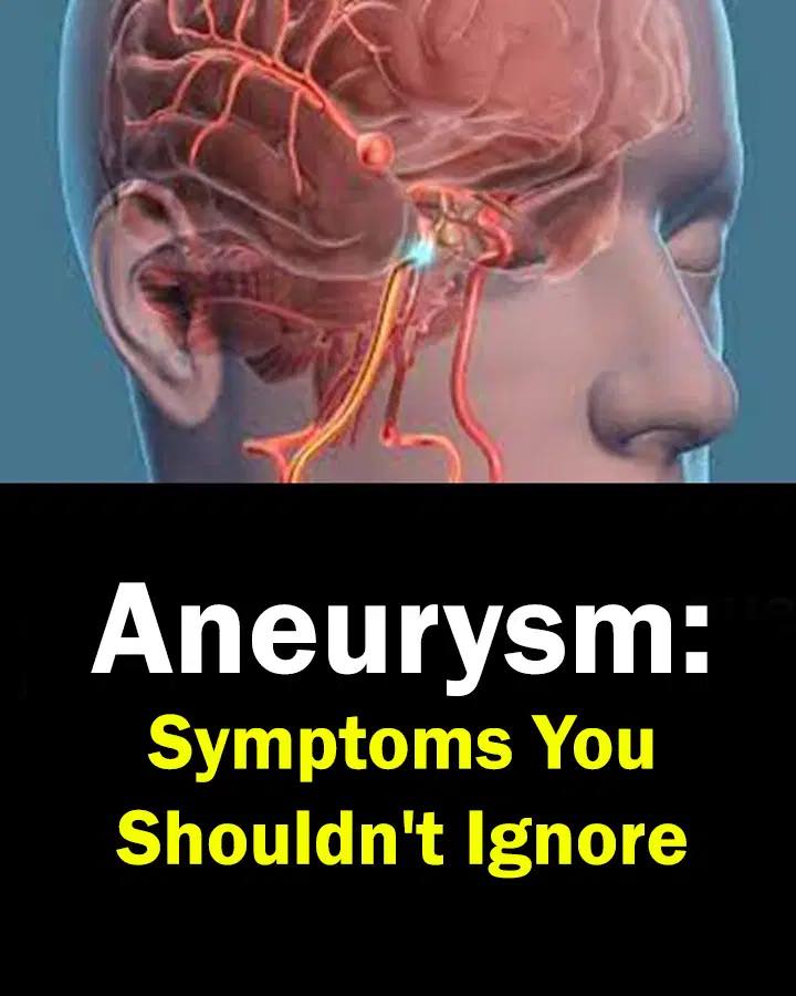 Aneurysm: Signs You Shouldn’t Ignore…..see more in (c.o.m.m.e.n.t ).👇