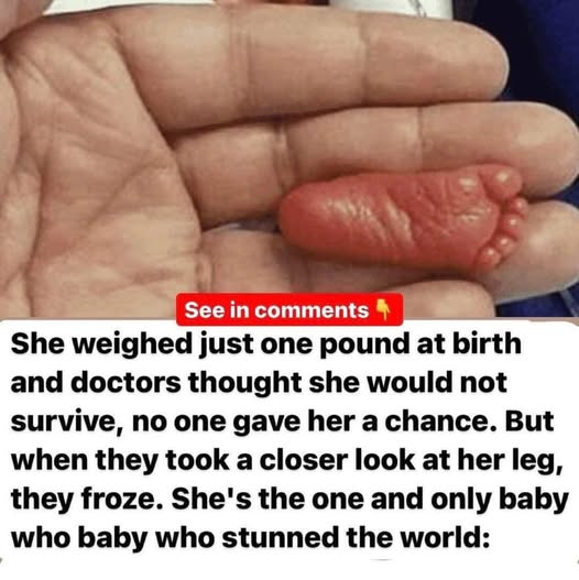 It was estimated that she had a chance of survival of only 0.5 percent.😳🙏 Read the full story below 👇