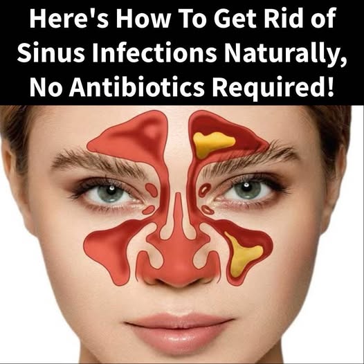 10 Natural Remedies To Help Deal With a Sinus Infection