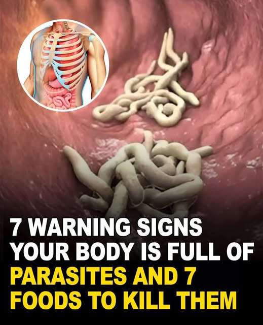 Your body could be hosting parasites without you even knowing. 😬🪱🪱🪱