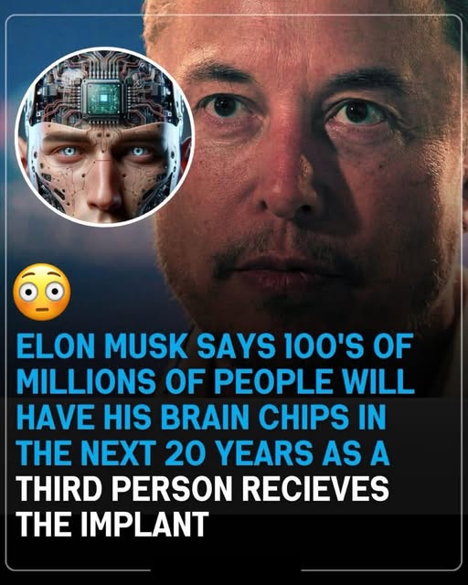 Elon predicts ‘hundreds of millions’ of people will have his brain chips implanted in the next 20 years. 🧠🤯(the 3rd person looks so weirdo! 😳🥺)