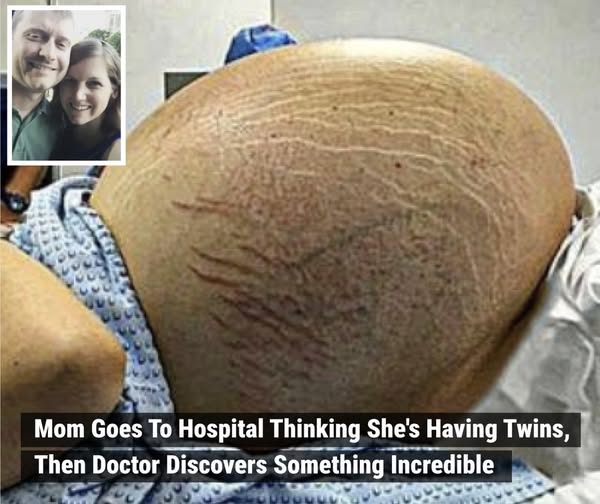 When they got to the hospital and the doctor looked at the ultrasound, he saw something that the mother couldn’t believe. How do you feel about this?